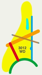 Logo vzw 3012WD